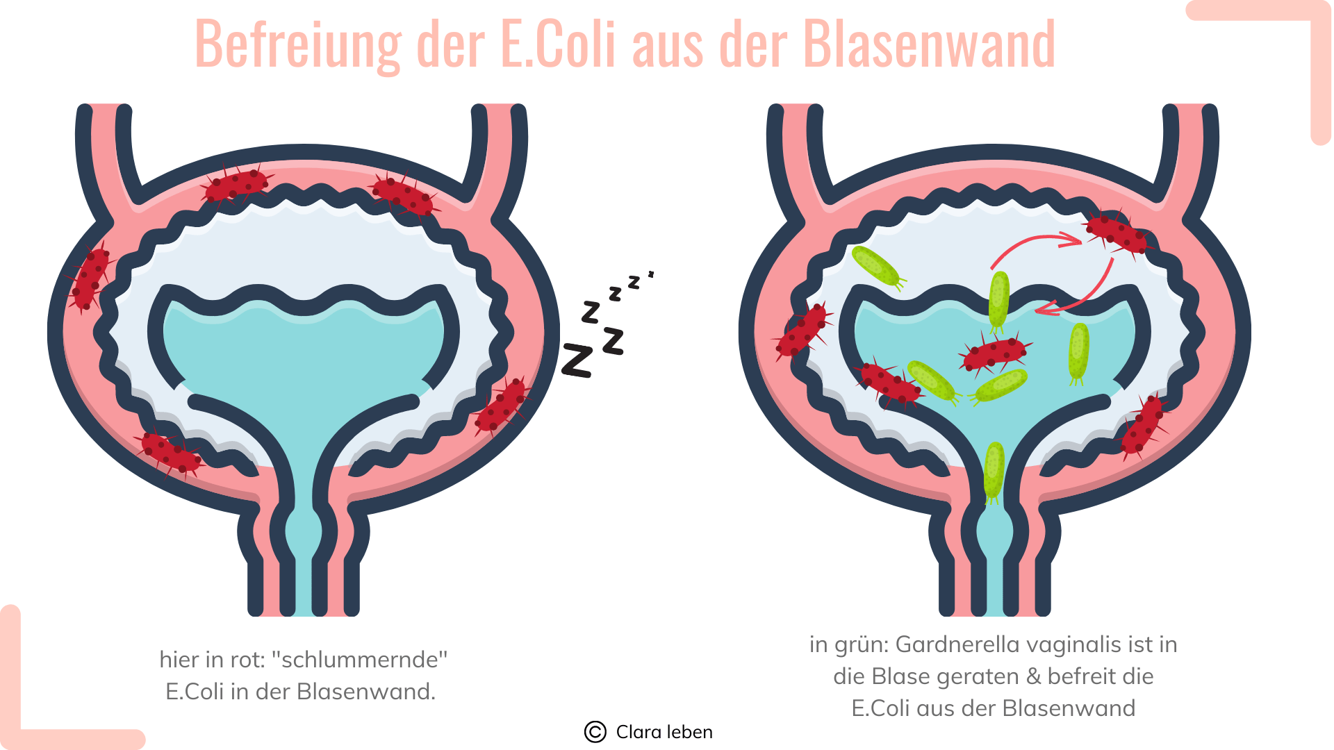 Wie Lange Mit Gv Warten Nach Blasenentzündung